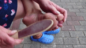 Outdoor Fußpflege am linken Fuss