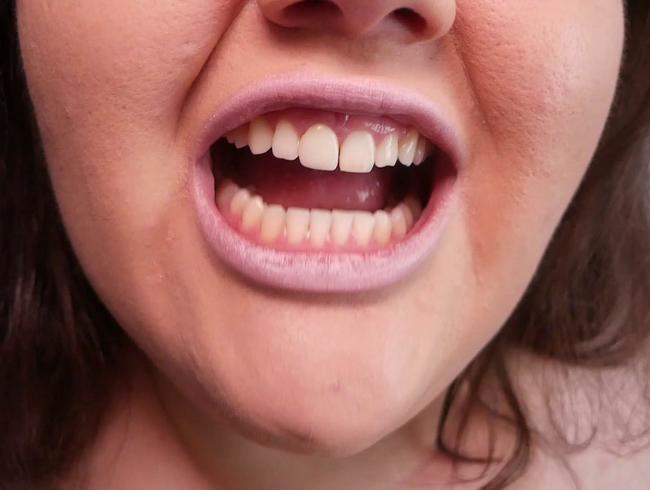 Schönheit in scharfen Zähnen: Die Kraft der Anziehung – (kein Reden)